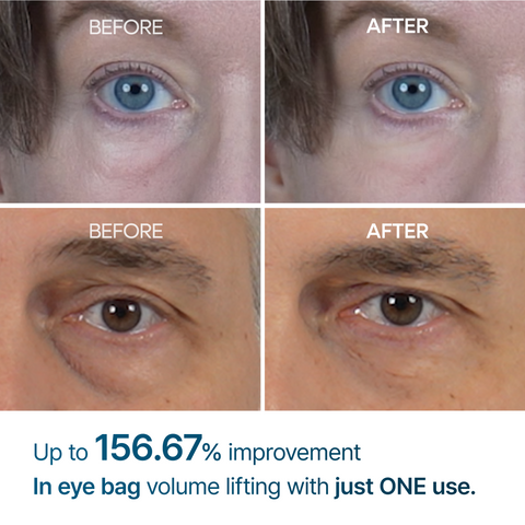 Dr. Melaxin Eyephalt eye cream